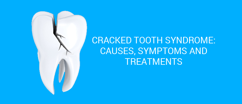 cracked tooth syndrome diagnosis treatment