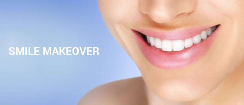 Dr. Bhutani Dental Clinic Is The Best Clinic In Delhi, Offers Smile Makeover Services In Delhi. Check Smile Makeover Cost In India.