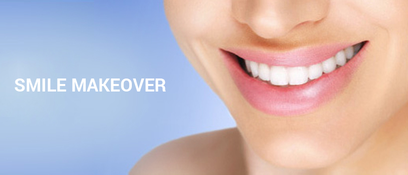 Dr. Bhutani Dental Clinic is the best clinic in Delhi, Offers Smile Makeover Services in Delhi. Check smile makeover cost in India.