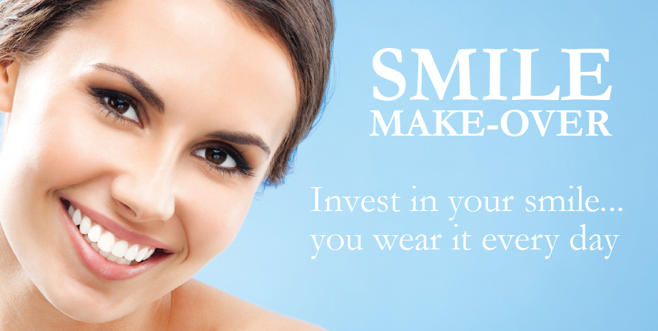 smile makeover cost