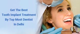 best tooth implant treatment in delhi