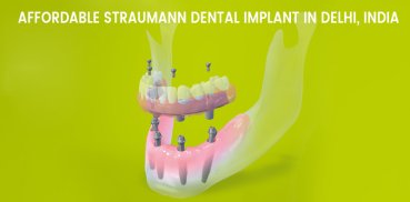 Straumann Teeth Implants