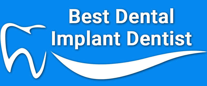 best implant dentist in Delhi