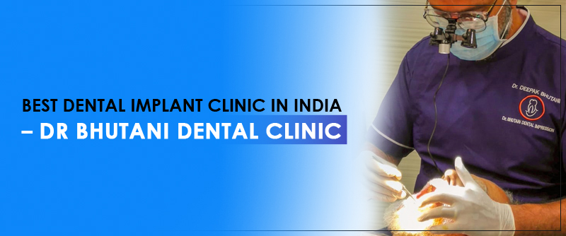 Best Dental Implant Clinic In India