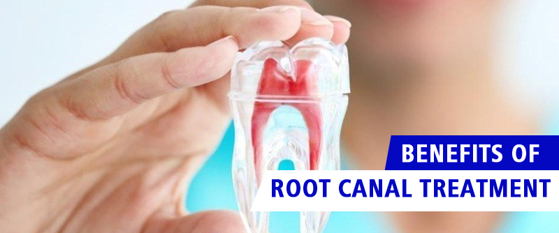 benefits of root Canal treatment