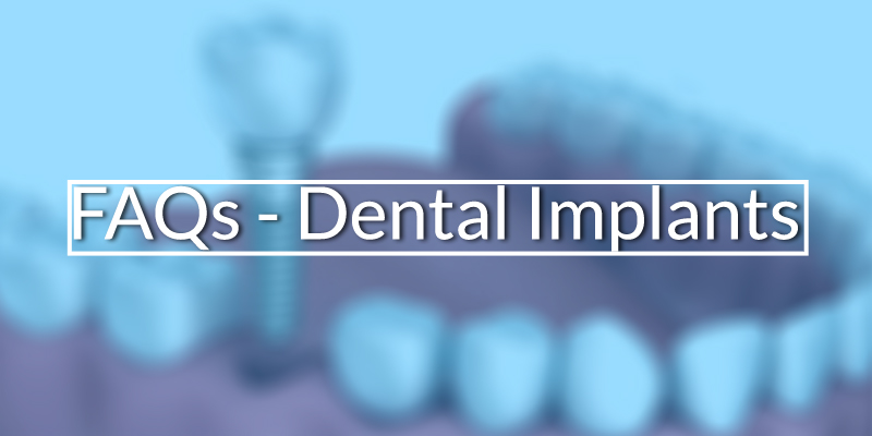 Dental Implants Treatment