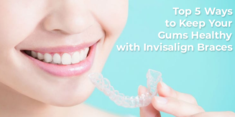 5 Ways To Keep Your Gums Healthy With Invisalign Braces