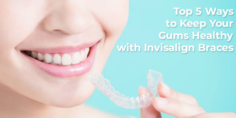 5 Ways to Keep Your Gums Healthy with Invisalign Braces