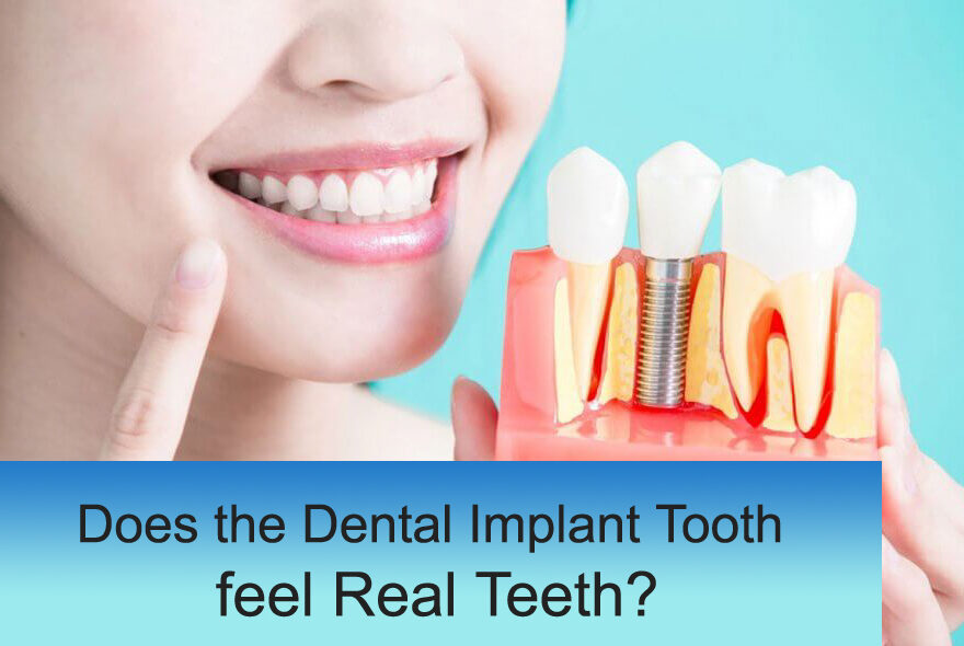 Best Implant Dentist In Delhi