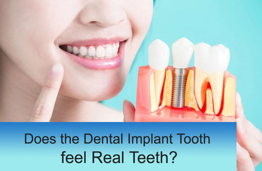 Best Implant Dentist in Delhi