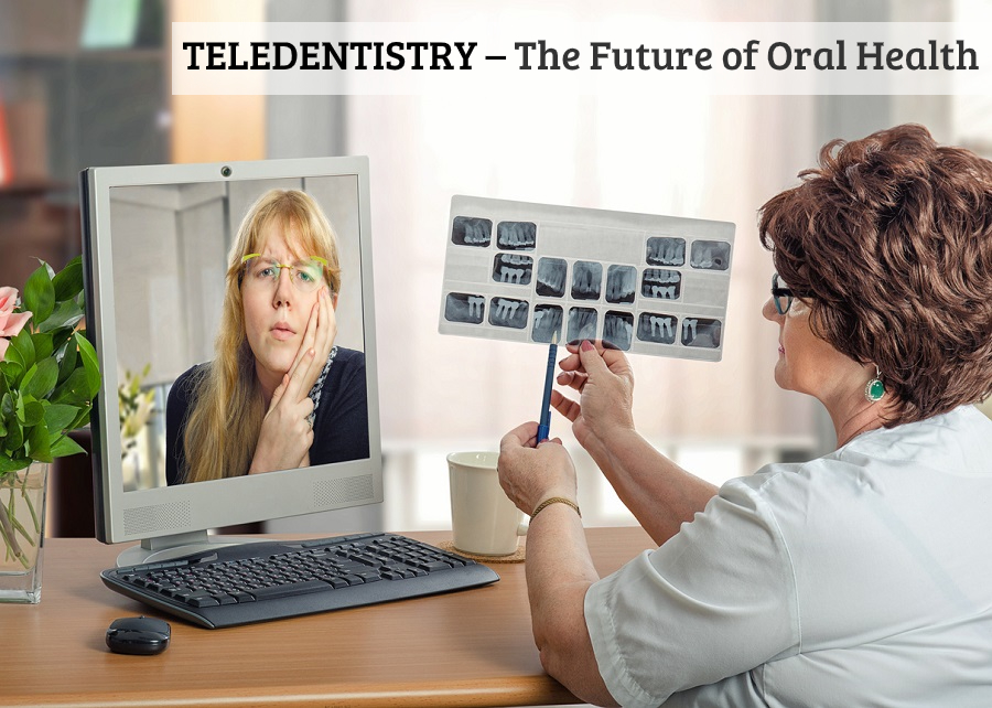 Teledentistry – The Future of Oral Health