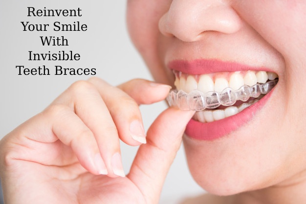 REINVENT YOUR SMILE WITH INVISIBLE TEETH BRACES