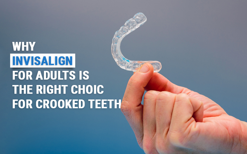 Invisalign For Adults