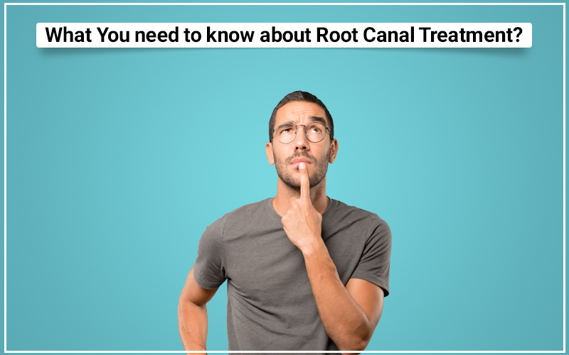What Do You Need To Know About Root Canal Treatment