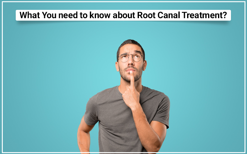 What do You need to know about Root Canal Treatment