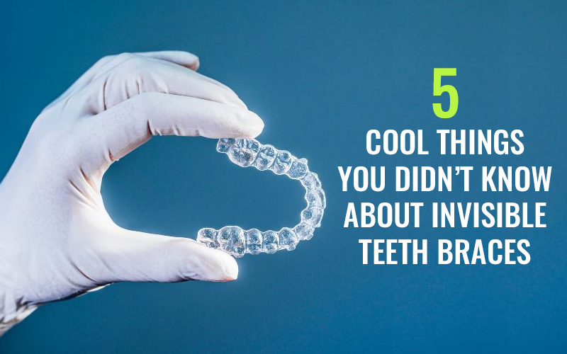5 Cool Things You Didn’t Know About Invisible Teeth Braces