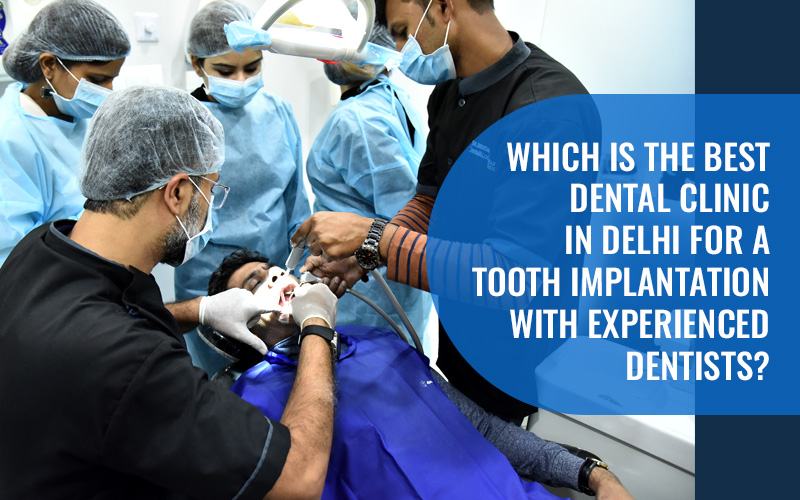 Best Dental Clinic For Tooth Implantation