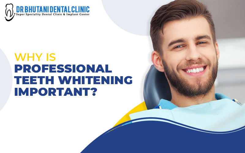 Professional Teeth Whitening