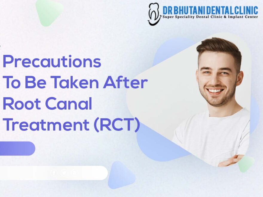 Precautions After Root Canal Treatment