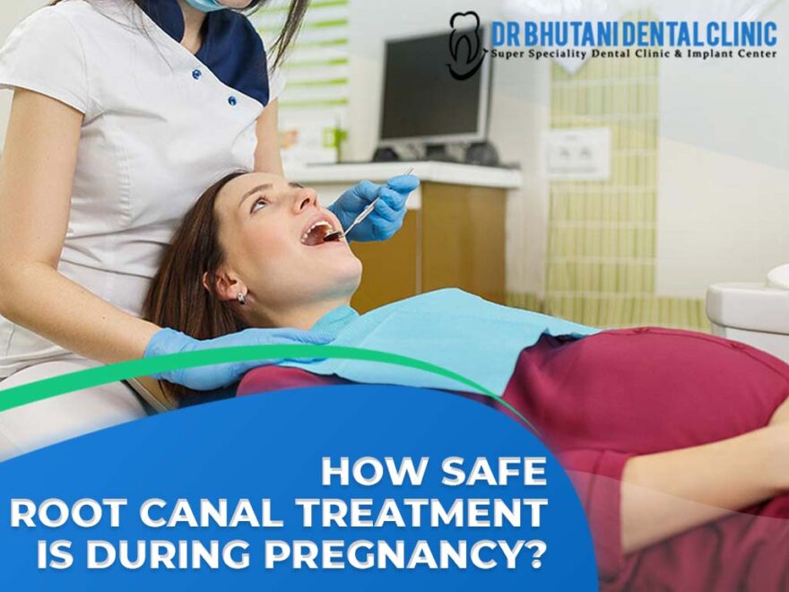 Root Canal Treatment During Pregnancy