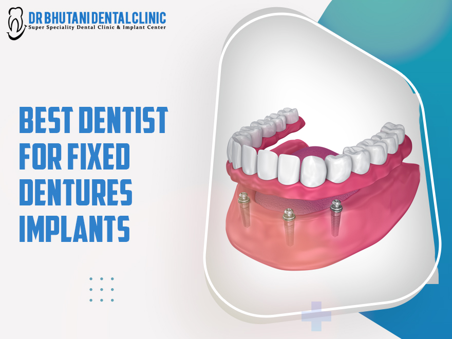 Best Dentist For Fixed Dentures Implants
