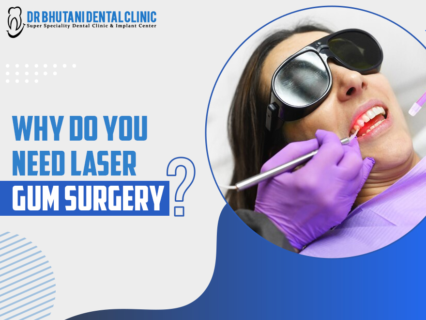 Laser Gum Surgery In Delhi