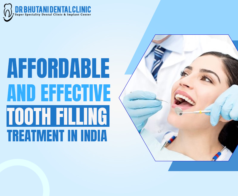 Tooth Filling Treatment In India