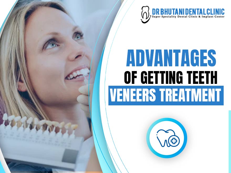 Advantages Of Veneers Treatment