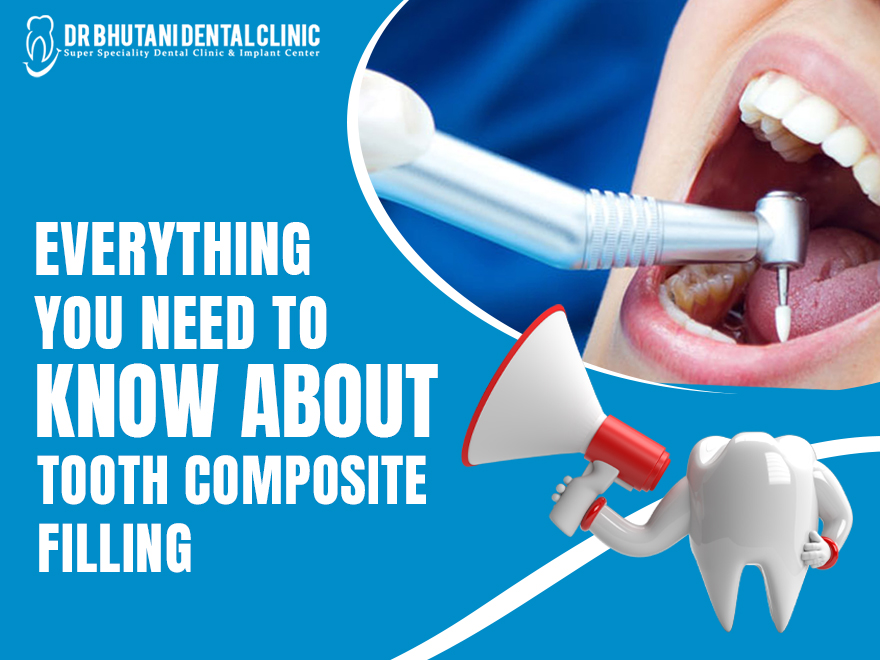 tooth composite filling treatment