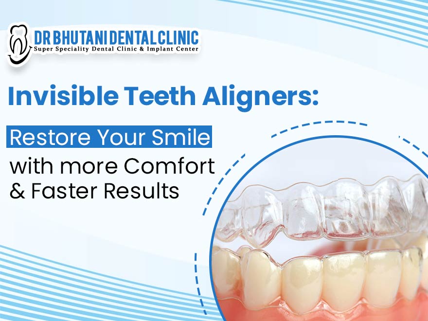 Invisible Teeth Aligners