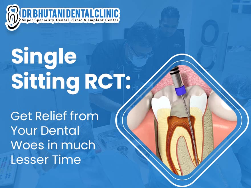 Single Sitting RCT