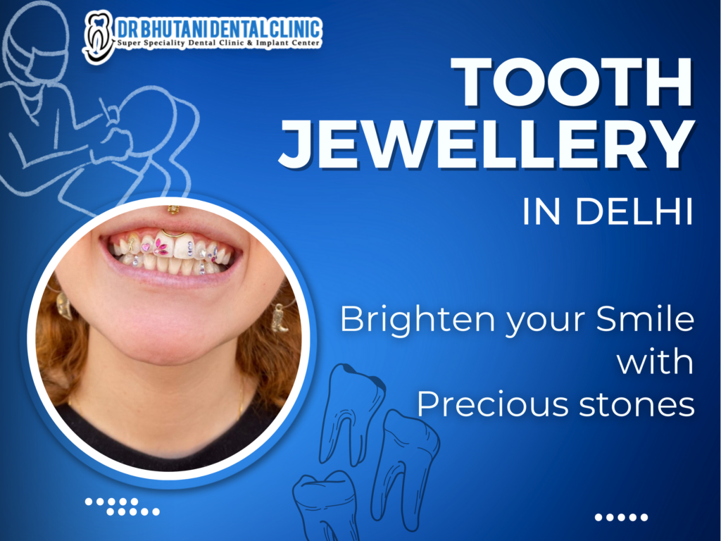 Tooth Jewellery in Delhi