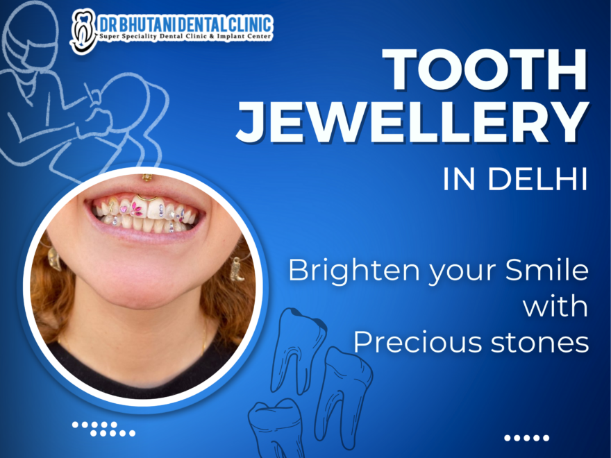 Tooth Jewellery In Delhi
