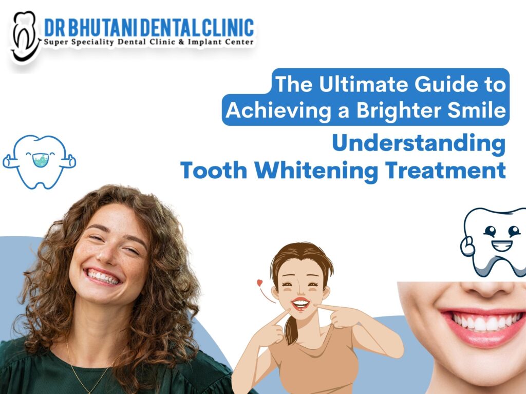 Teeth Whitening Treatment