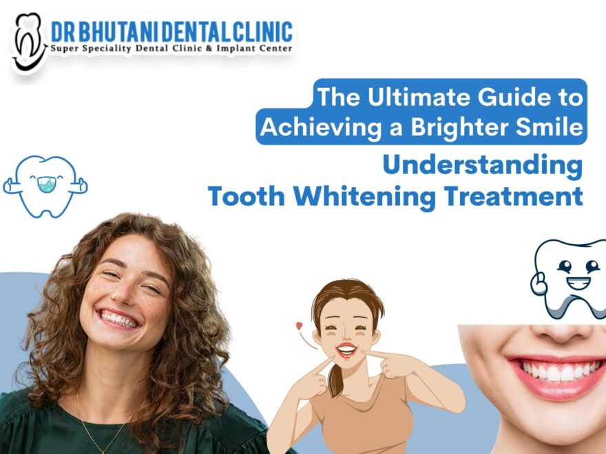 Teeth Whitening Treatment