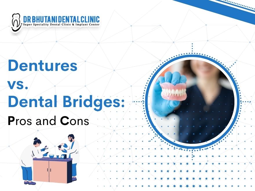 dental bridges vs dentures