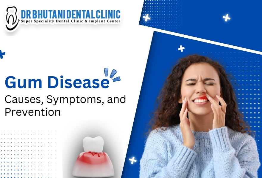 Gum Disease