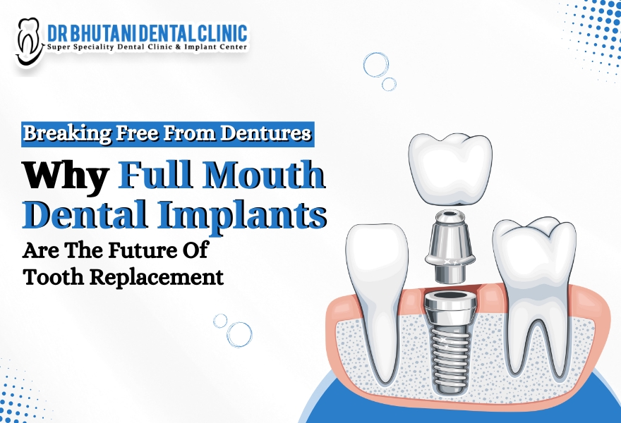 Dental Implants Clinic