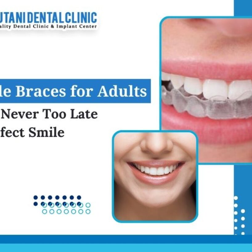 Invisible Braces Options For Adults