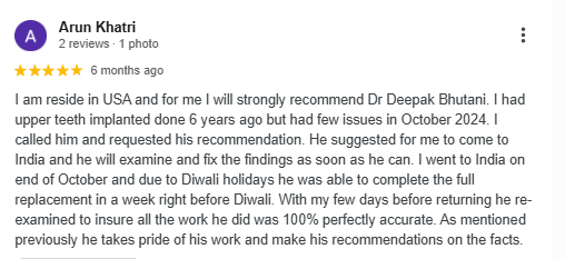 dental implants treatment