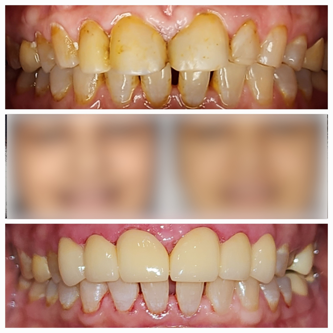 best dental tourism clinic in delhi