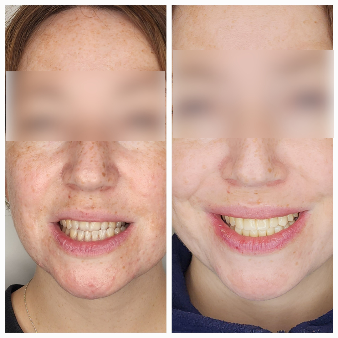 dental tourism in delhi