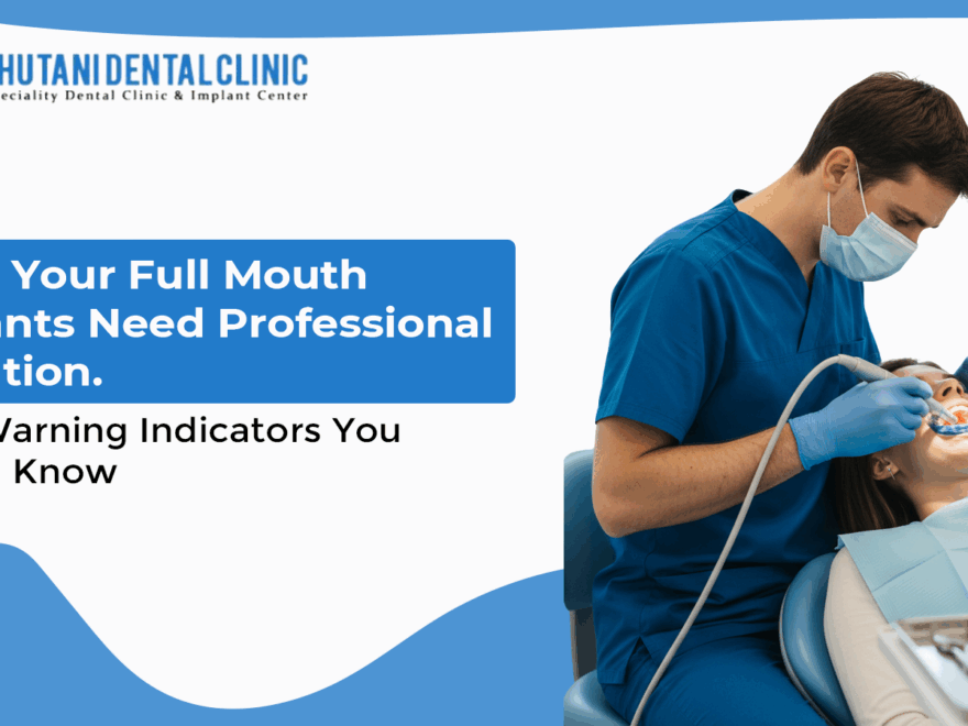 Full Mouth Dental Implants