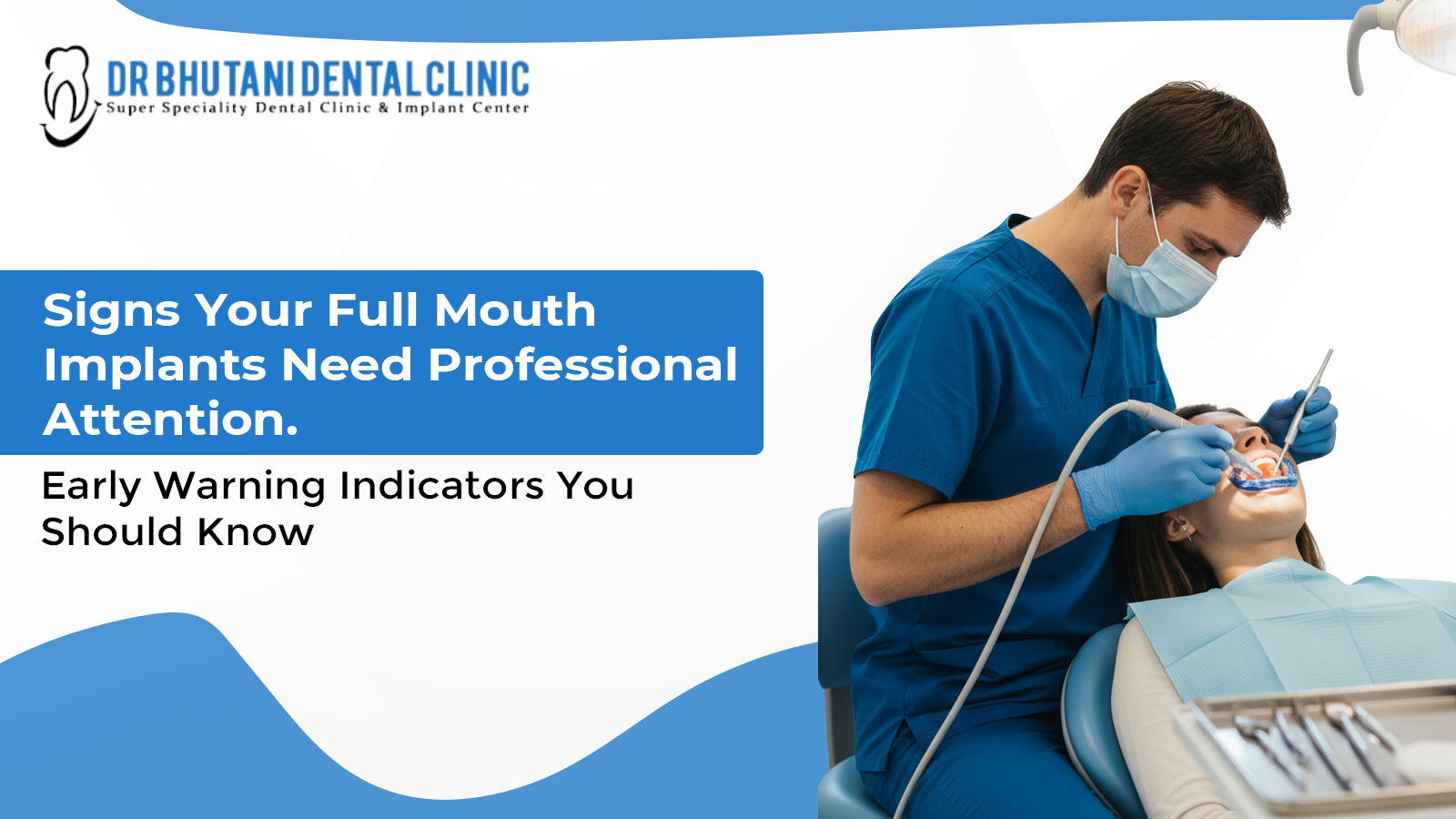 Full mouth dental implants