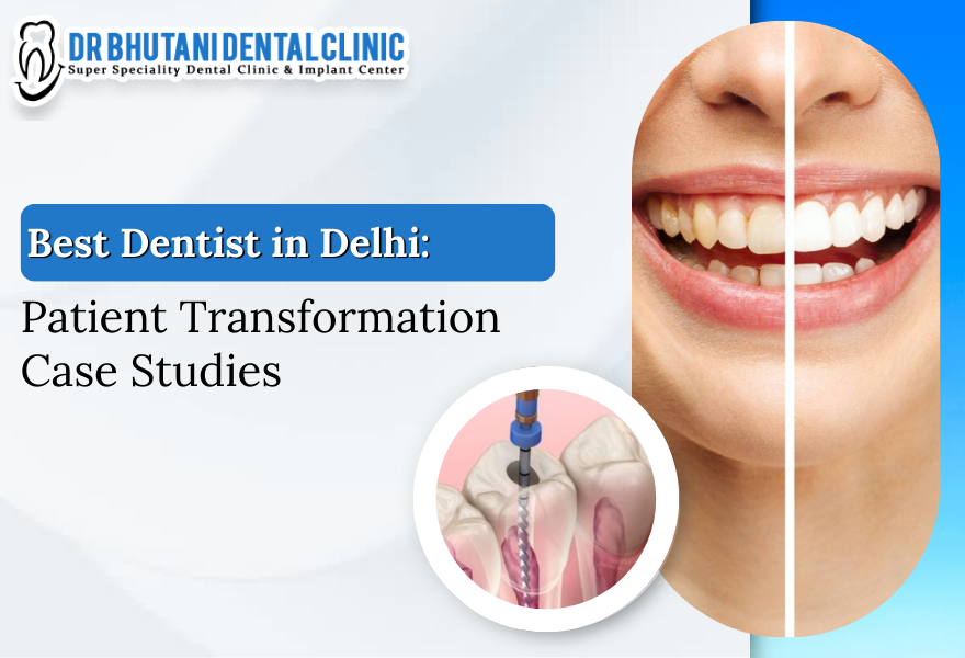 Dentist In Delhi Dr. Bhutani Dental Clinic