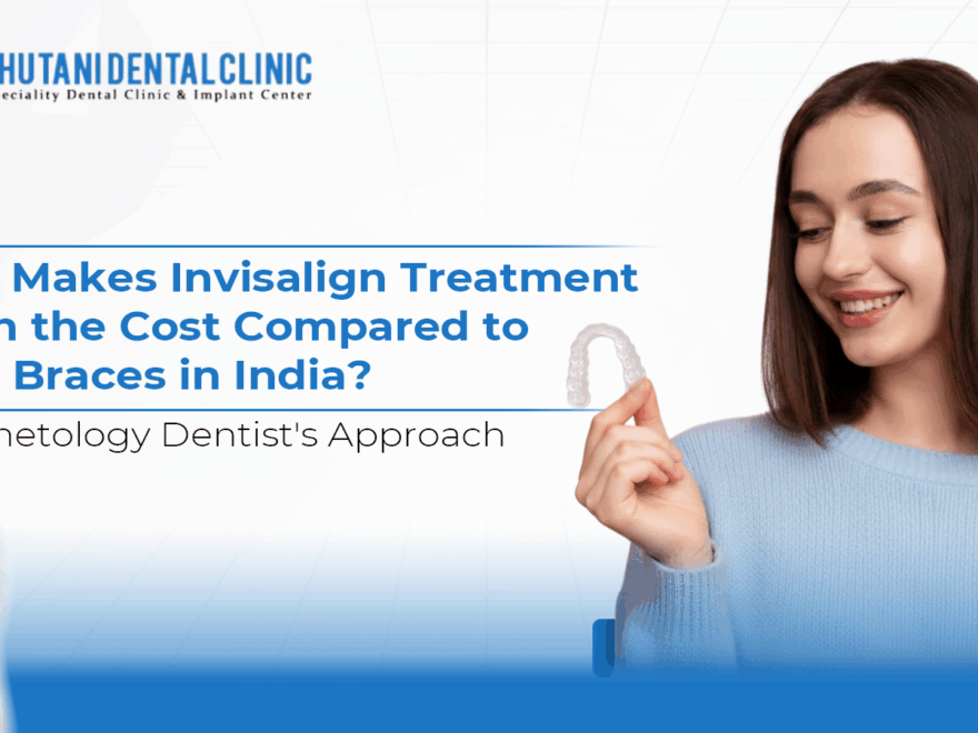 Clear Aligners Treatment