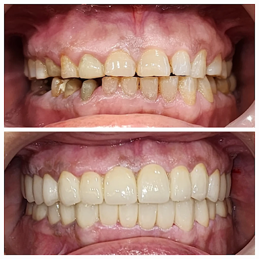 Best root canal dentist in delhi