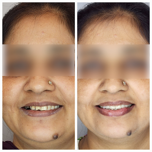 best dentist in delhi dr. bhutani dental clinic 