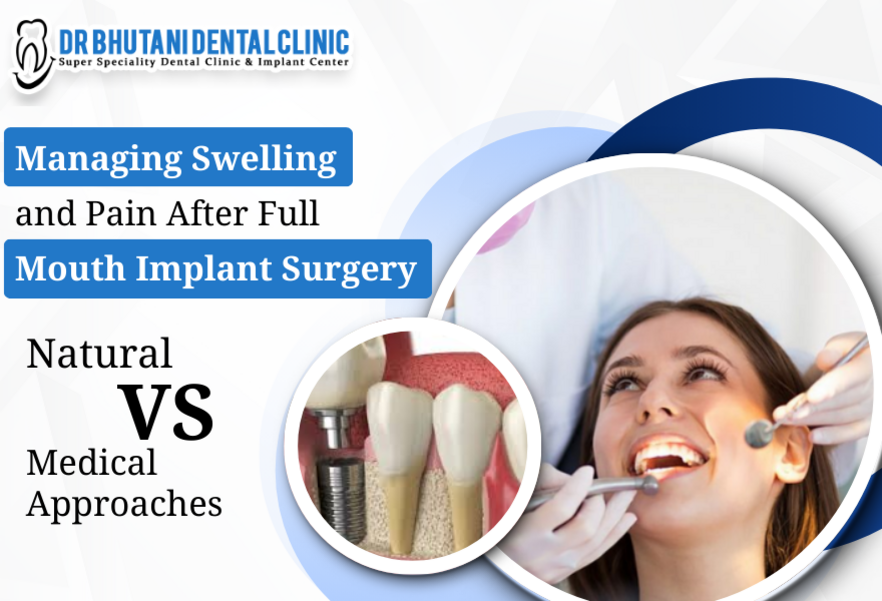Managing Swelling and Pain After Full Mouth Implant Surgery: Natural vs Medical Approaches