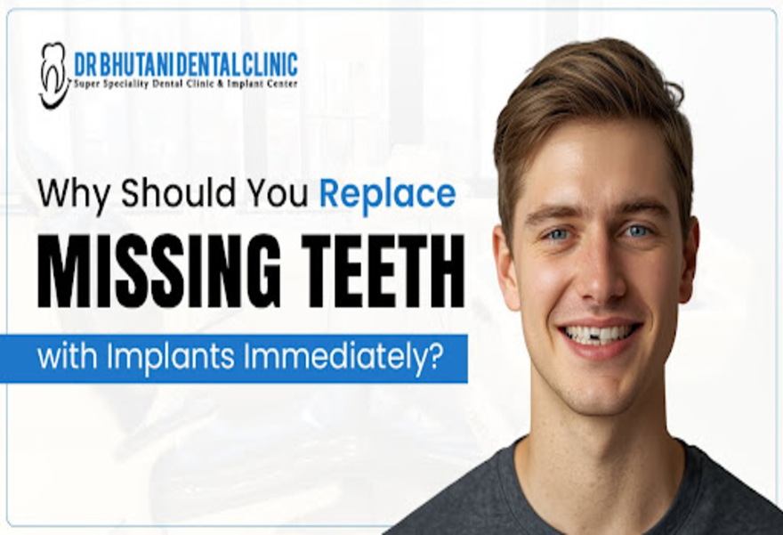 Missing Teeth Treatment In Delhi